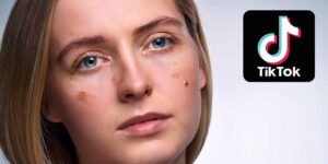 „Cortisol Face“ auf TikTok