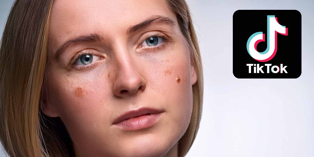 „Cortisol Face“ auf TikTok